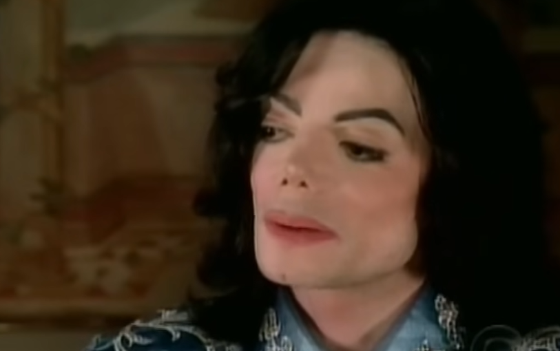 Michael Jackson Disease Michael Jackson Disease